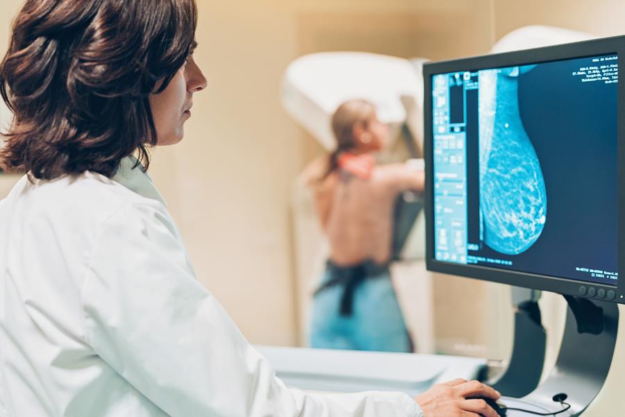 Une personne sur 400 est porteuse d'une mutation génétique BRCA